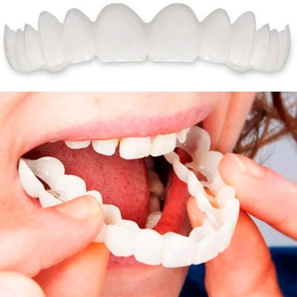 Dental White - Snap On Smile - Sonrisa perfecta con comodidad y practicidad