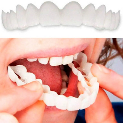 Dental White - Snap On Smile - Sonrisa perfecta con comodidad y practicidad