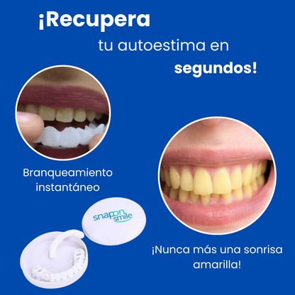 Dental White - Snap On Smile - Sonrisa perfecta con comodidad y practicidad